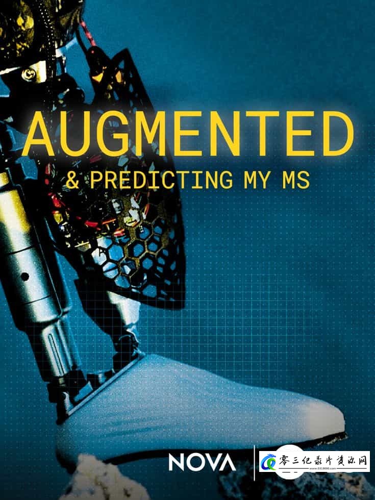 健康&医学纪录片《我的多发性硬化症增强与预测 Augmented & Predicting My MS》下载-零三纪录片资源网