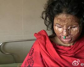 无脸女孩 The Girl Who Lost Her Face的海报